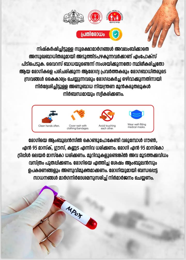 എം പോക്സ്